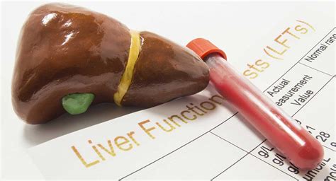 How To Read Your Liver Blood Tests Cabot Health