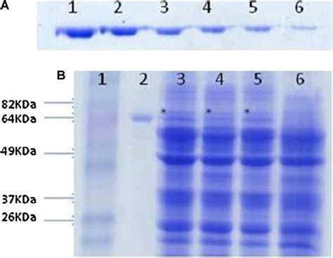 Densitometry By Sds Page Of Rabies Virus G Protein Expressed By