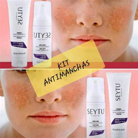 Kit antimanchas Cicatrices de acne Productos para el acné Limpiador