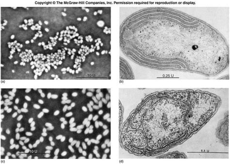 Nitrosomonas Europaea | Patient history, Free medical, Microbiology