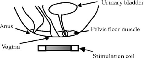 Figure 1 From Comparison Of Current Distribution Based On Tissue