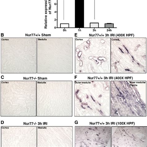 Expression Pattern Of Nur77 In The Tubular Epithelial Cells During