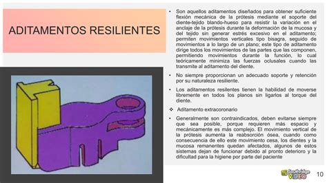 Aditamentos Protesis Removible Dentales Ppt