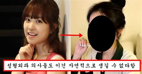 현재 쌍수한거 빼박이라고 난리 난 박보영 최근 충격적인 눈 상태 낼 뭐하지