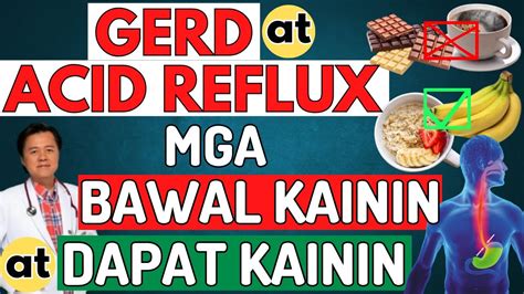 Gerd At Acid Reflux Mga Bawal Kainin At Dapat Kainin By Doc Willie