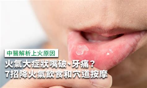 火氣大症狀嘴破、牙痛？7招降火氣飲食和穴道按摩方法 康健雜誌