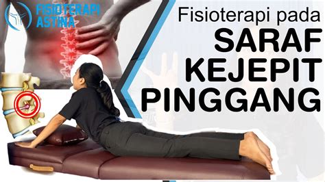 Saraf Kejepit Pinggang Hnp Fisioterapi Cara Mengobati Syaraf