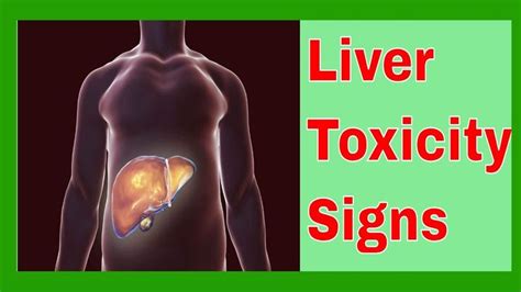 Liver Toxicity Signs Con Imágenes