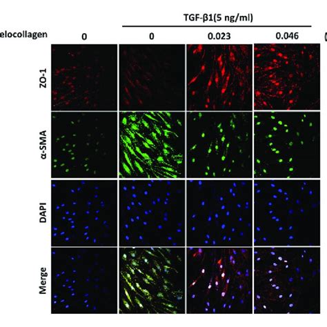 Immunofluorescence Analysis Of Sma And Zonular Occludens Scaffolding