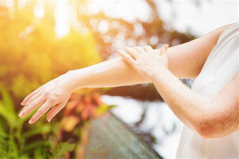 Inestetismi Causati Dal Sole Cosa Comporta Il Fotoaging Dott Ssa