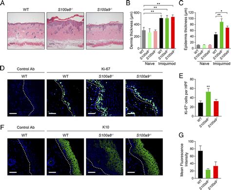 S100a8 Regulates Keratinocyte Proliferation And Differentiation A