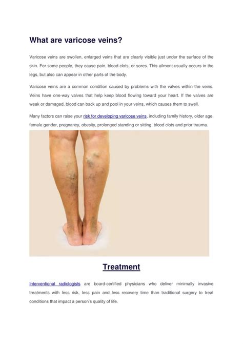 Ppt Varicose Veins Powerpoint Presentation Free Download Id 7810256