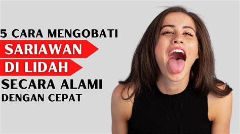 Cara Mengobati Sariawan Di Lidah Secara Alami Dengan Cepat Youtube