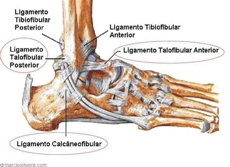 Entorse de tornozelo causas e tratamentos Dr Márcio Silveira