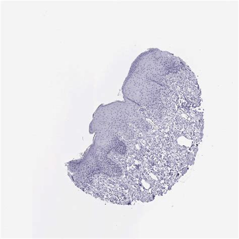 Tissue Expression Of GLA Staining In Skin The Human Protein Atlas