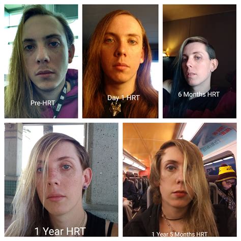 Mtf 27 1 Year And 5 Months On Hrt Rtranstimelines