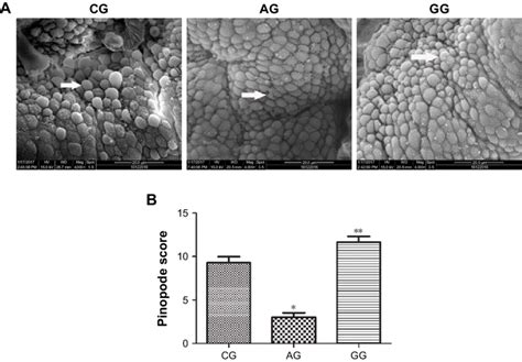 Scanning Electron Microscopy Images Of Pinopodes In The Endometrium