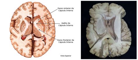 Redes Neurais A Anatomia Da Subst Ncia Branca Cerebral