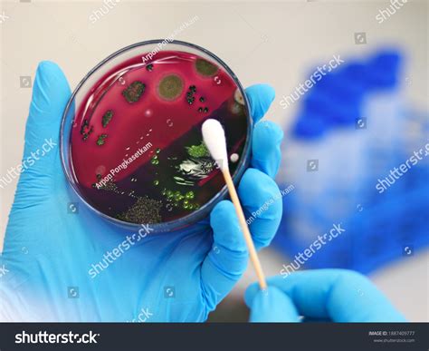 Scientist Analysis Escherichia Coli Ecoli Culture Stock Photo