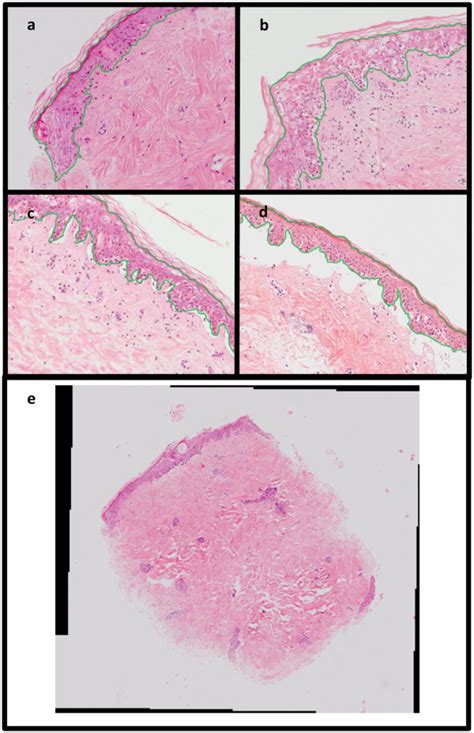 Digital Images Of H E Stained Skin Showing Varying Levels Of