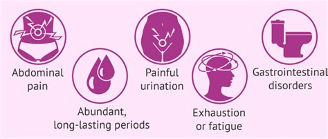 Symptoms Of Endometriosis