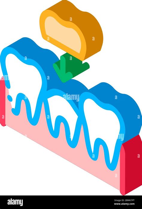 Stomatology Tooth Crown Isometric Icon Vector Illustration Stock Vector