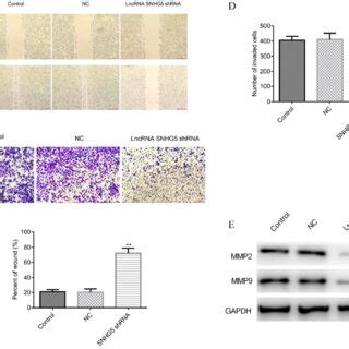 Knockdown Of Snhg Inhibits The Migration And Invasion Of Dlbc Cells In