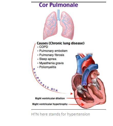 Left Ventricular Hypertrophy Causes Sequential Compensatory