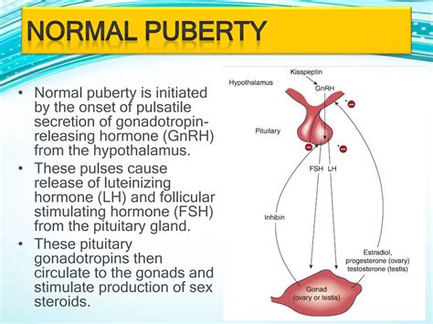 Delayed Puberty Ppt Ppt