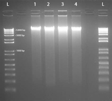 Quality Control Of DNA Samples Evaluated Through Gel Electrophoresis L