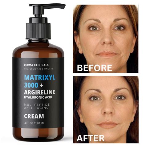 Matrixyl 3000 Argireline Hyaluronic Acid Peptide Anti Aging Serum Wrinkle Cream 4oz Etsy