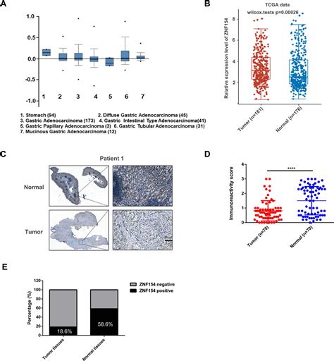 Figure From Low Expression Of Znf Is Related To Poor Prognosis In