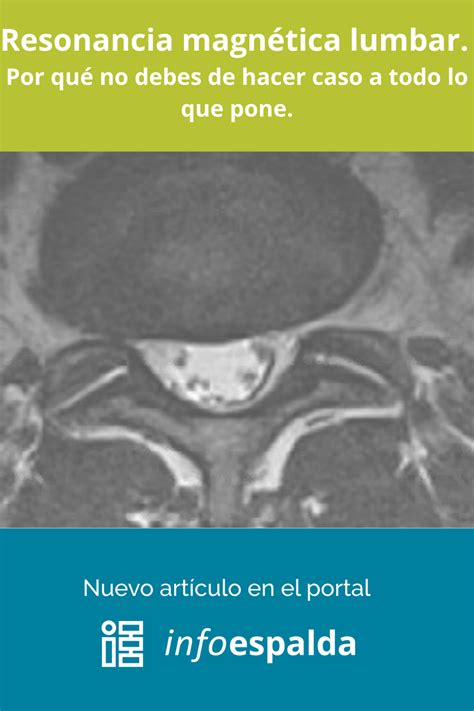 Muchas veces tenomos una fé ciega en el informe de la resonancia Pero