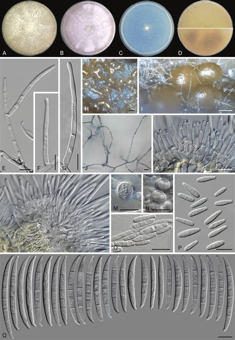 Fusarium Madaense Sp Nov Ex Type Culture Cbs A C Aspect Of