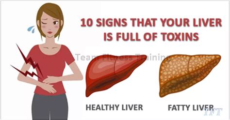 6 Signs That Your Liver Is Full Of Toxins And Making You Fat