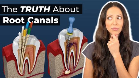 Root Canal Procedure