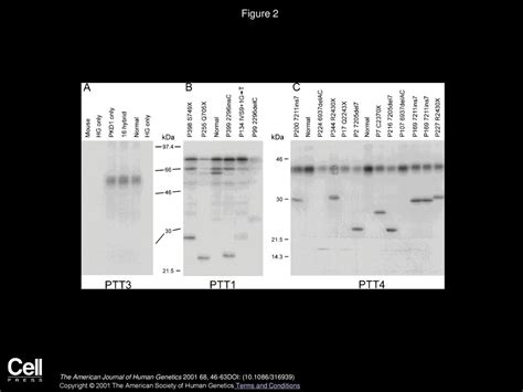 Mutation Analysis Of The Entire Pkd1 Gene Genetic And Diagnostic