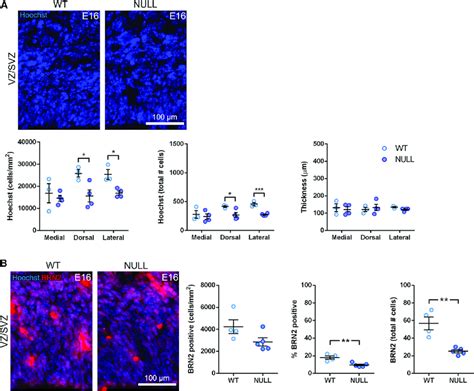 MGAT5 Deficiency Causes Depletion Of Embryonic VZ SVZ Cells And Upper