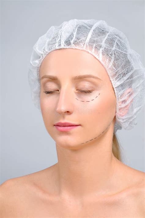 Chirurgie Plastique Femme Avec Des Lignes De Perforation Sur Le Visage