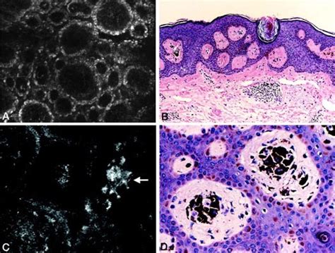 Morphologic Features Of Melanocytes Pigmented Keratinocytes And