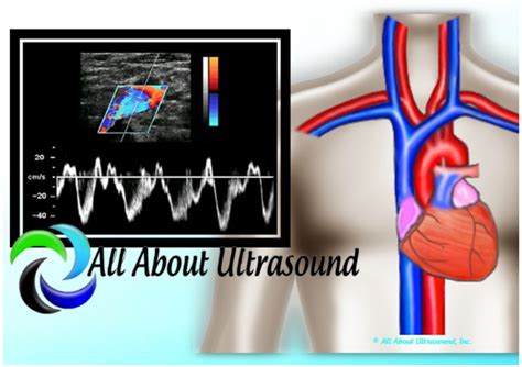 FREE SAMPLE Advanced Cardiac Sonographer ACS Registry Review Test