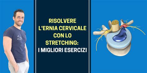 Risolvere L Ernia Cervicale Con Lo Stretching I Migliori Esercizi