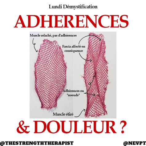 D Mystifions Les Adh Rences Physio Network