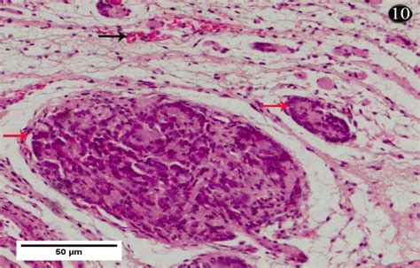 Photomicrograph Of The Uterine Cervix Of 280 Mm CVRL Stage Showing The