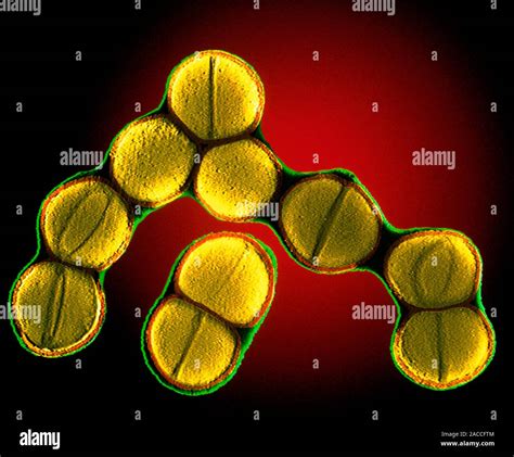 Staphylococcus Sp Bacteria Coloured Transmission Electron Micrograph