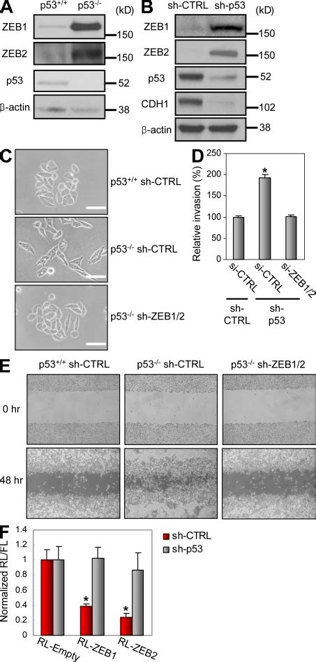 P53 Inhibits Emt Through Zeb1 And Zeb2 Repression In A Open I