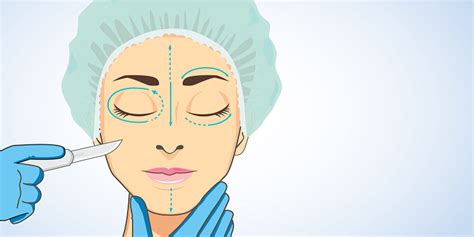 What's the Typical Recovery Time for a Facelift? | MD.com Blog