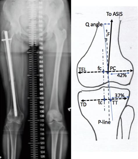 Asis Radiology