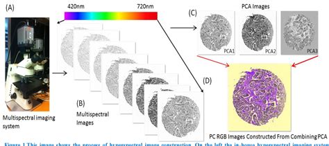 Figure 1 From Automated Prostate Glandular And Nuclei Detection Using