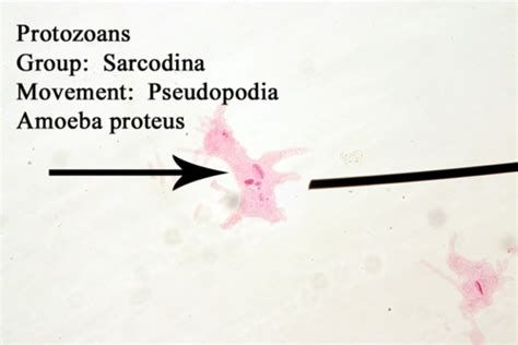 Microbiology Lab Practical Flashcards Quizlet